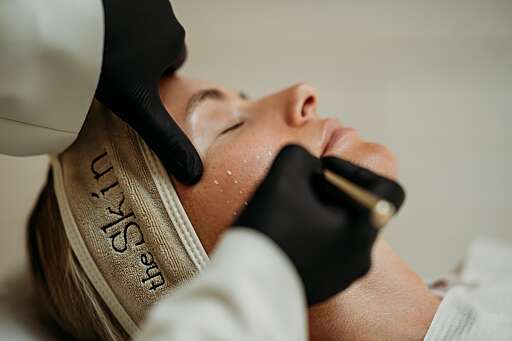 Skinbooster-Behandlung im Wangenbereich bei THE SKIN in Heilbronn